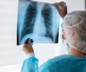 radiologi